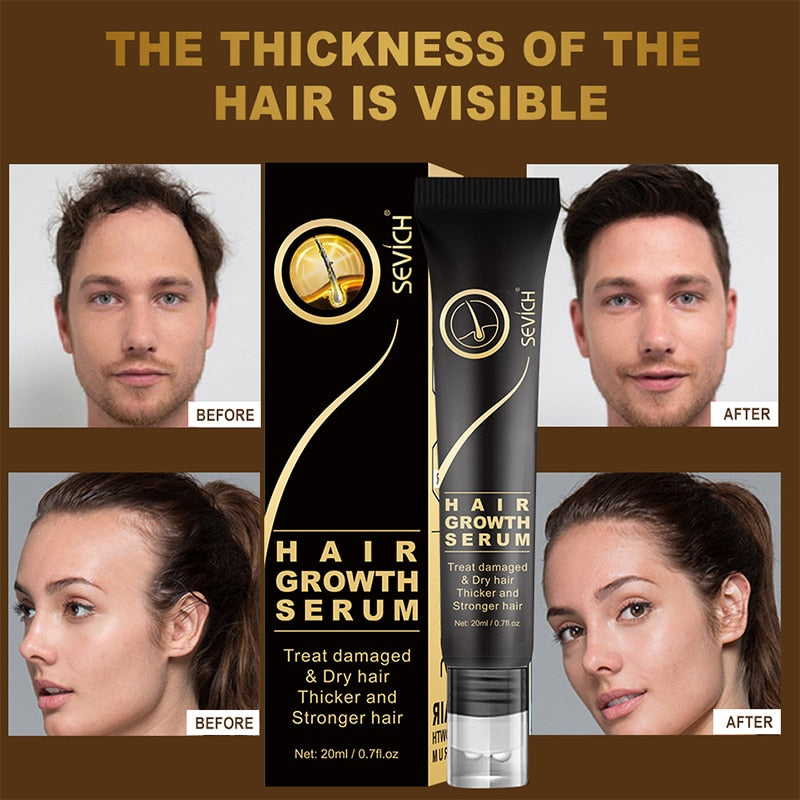100% Natural Hair Growth Essential Anti Hair Loss Serum - optionsgaloreonlinestore